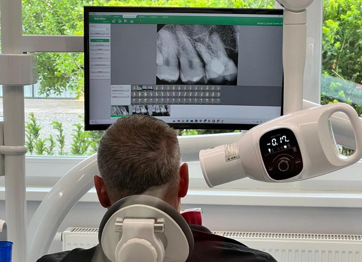 Dentale usluge Zagreb - Mala Mlaka - Digitalna periapikalna RTG snimka